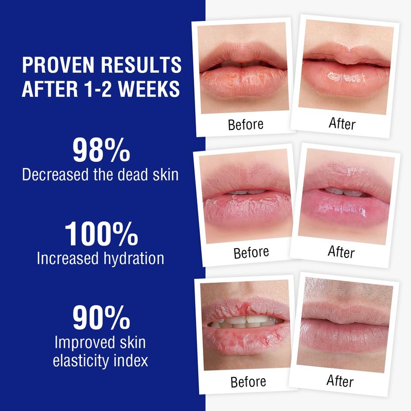 OUKEYA Lip Balm,0.25 Ounce,6Counts,Medicated Lip Chapstick Medicated w/Beeswax,Petrolatum,Peppermint Oi,100% Natural Ingredients,Medicated Lip Balm Lip Moisturizer for Echapped Lips Treatment